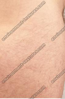 human skin hairy 0016